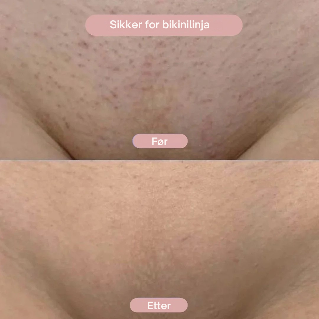 SilkPro™ - 2-i-1 Barbermaskin for Kvinner